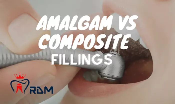 Amalgam Fillings Vs Composite Fillings